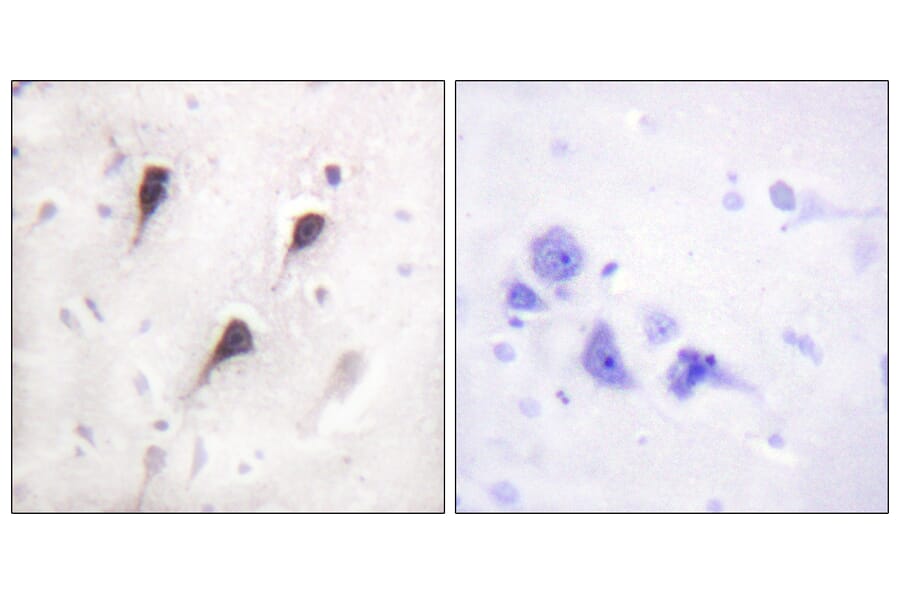 Immunohistochemistry - Anti-WAVE1 Antibody (B0598) - Antibodies.com