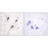 Immunohistochemistry - Anti-WAVE1 Antibody (B0598) - Antibodies.com