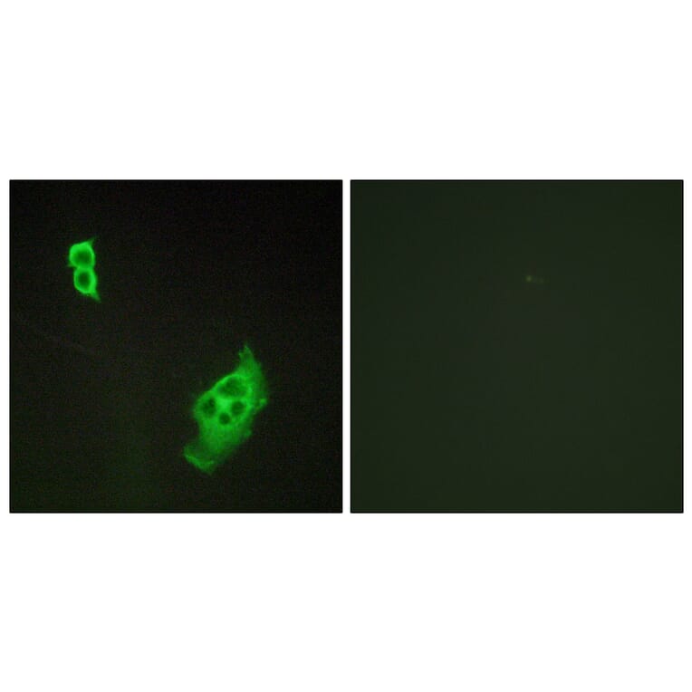 Immunofluorescence - Anti-WAVE1 Antibody (B0598) - Antibodies.com