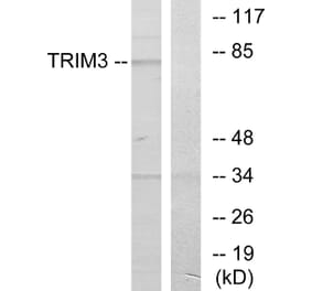 Western Blot - Anti-TRIM3 Antibody (C10169) - Antibodies.com