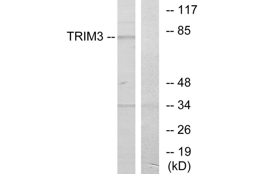 Western Blot - Anti-TRIM3 Antibody (C10169) - Antibodies.com