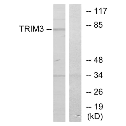 Western Blot - Anti-TRIM3 Antibody (C10169) - Antibodies.com