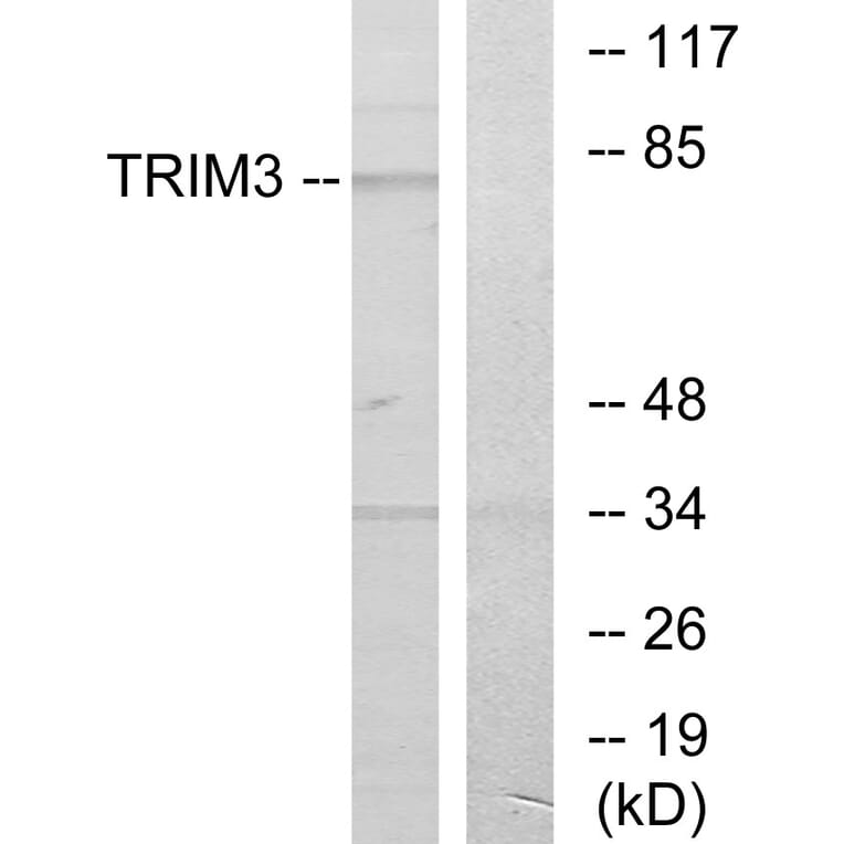 Western Blot - Anti-TRIM3 Antibody (C10169) - Antibodies.com