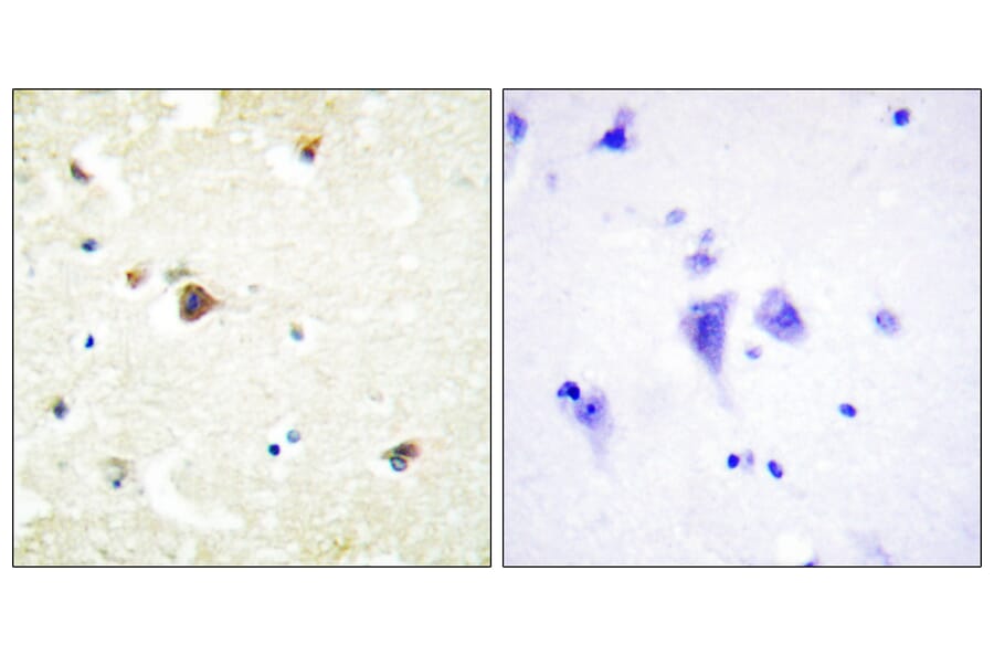 Immunohistochemistry - Anti-TRIM3 Antibody (C10169) - Antibodies.com