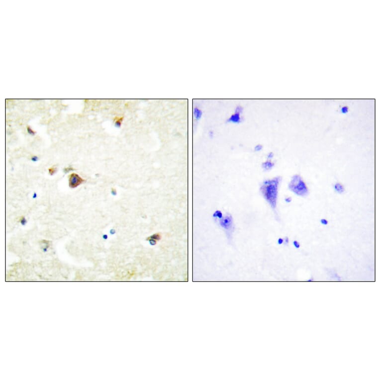 Immunohistochemistry - Anti-TRIM3 Antibody (C10169) - Antibodies.com