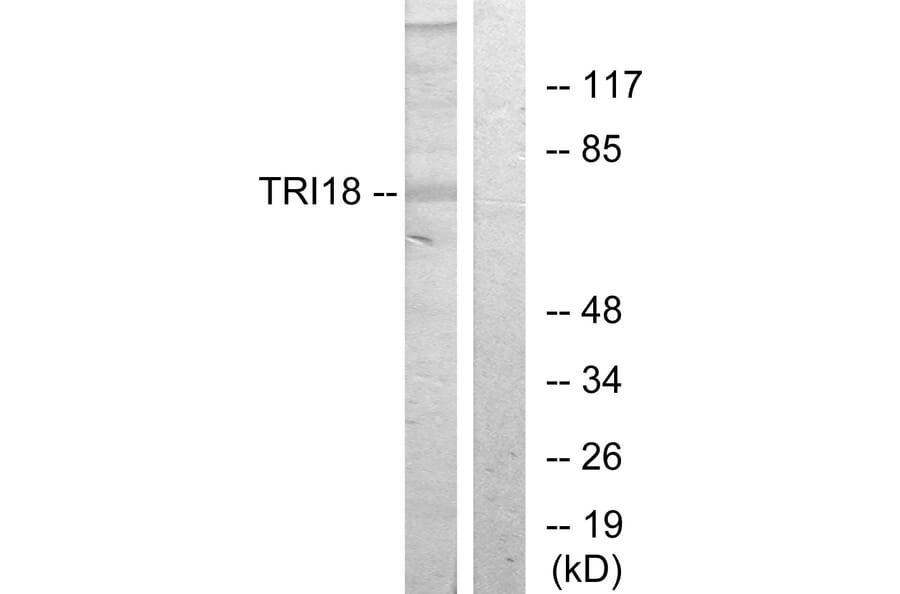 Western Blot - Anti-TRI18 Antibody (C10078) - Antibodies.com