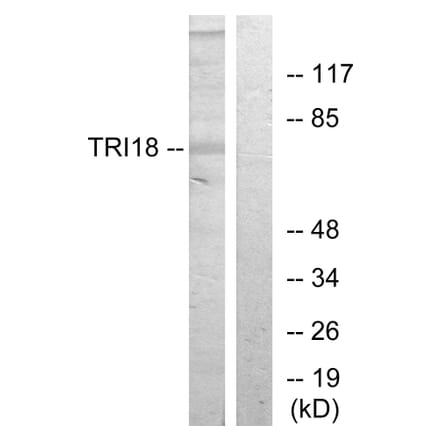 Western Blot - Anti-TRI18 Antibody (C10078) - Antibodies.com