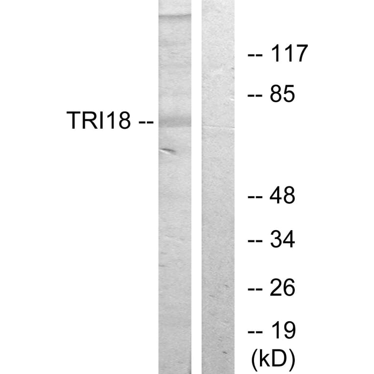 Western Blot - Anti-TRI18 Antibody (C10078) - Antibodies.com