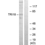 Western Blot - Anti-TRI18 Antibody (C10078) - Antibodies.com