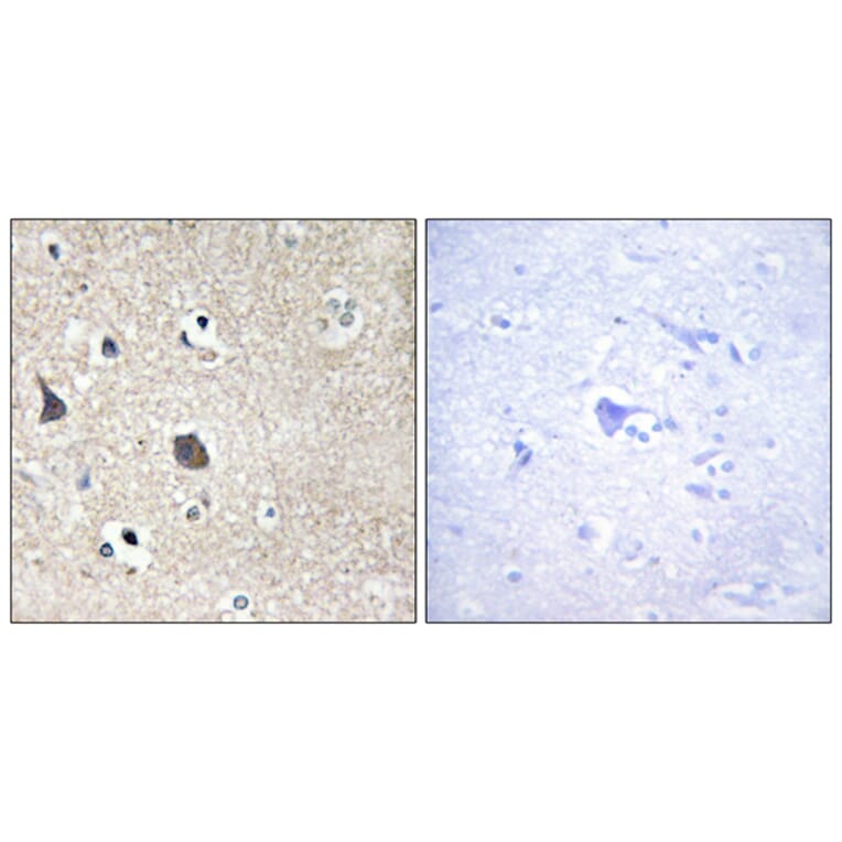 Immunohistochemistry - Anti-TRI18 Antibody (C10078) - Antibodies.com
