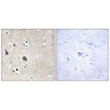 Immunohistochemistry - Anti-TRI18 Antibody (C10078) - Antibodies.com