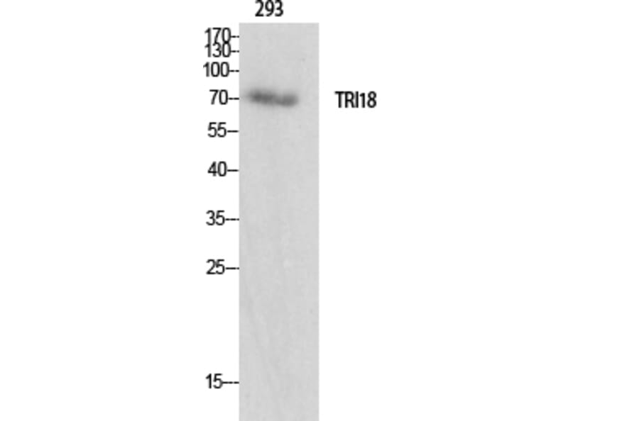 Western Blot - Anti-TRI18 Antibody (C10078) - Antibodies.com