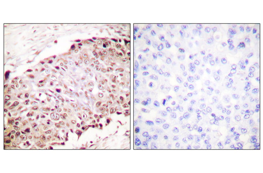 Immunohistochemistry - Anti-Sumo1 Antibody (C0372) - Antibodies.com
