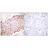 Immunohistochemistry - Anti-Sumo1 Antibody (C0372) - Antibodies.com