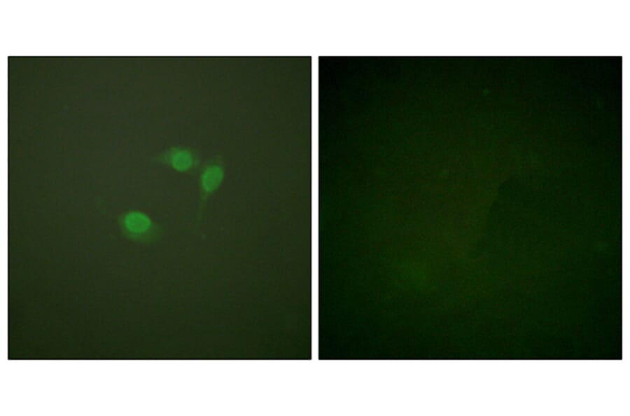 Immunofluorescence - Anti-Sumo1 Antibody (C0372) - Antibodies.com