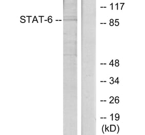 Western Blot - Anti-STAT6 Antibody (B7228) - Antibodies.com