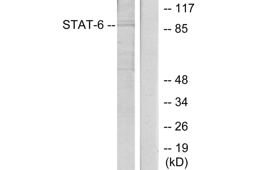 Western Blot - Anti-STAT6 Antibody (B7228) - Antibodies.com