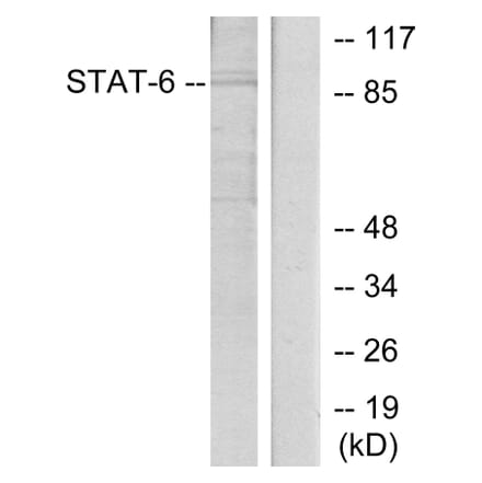 Western Blot - Anti-STAT6 Antibody (B7228) - Antibodies.com