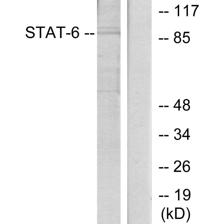 Western Blot - Anti-STAT6 Antibody (B7228) - Antibodies.com