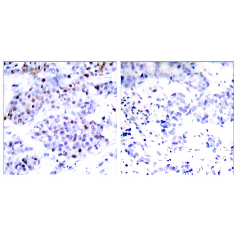 Immunohistochemistry - Anti-STAT6 Antibody (B7228) - Antibodies.com