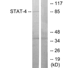 Western Blot - Anti-STAT4 Antibody (B7225) - Antibodies.com