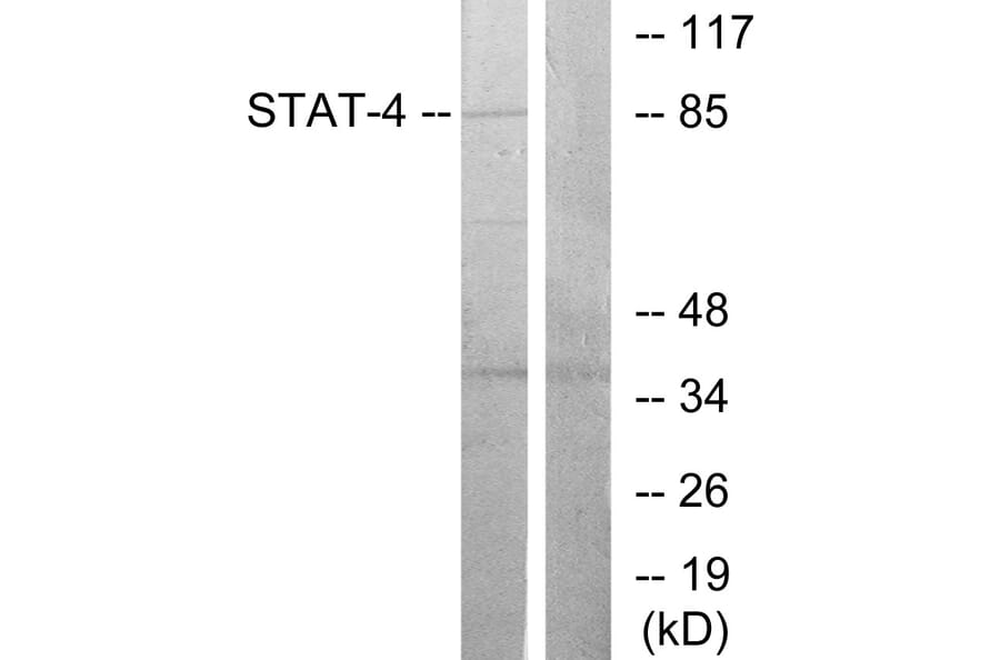 Western Blot - Anti-STAT4 Antibody (B7225) - Antibodies.com