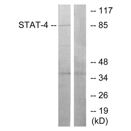 Western Blot - Anti-STAT4 Antibody (B7225) - Antibodies.com