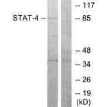 Western Blot - Anti-STAT4 Antibody (B7225) - Antibodies.com