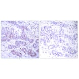 Immunohistochemistry - Anti-STAT4 Antibody (B7225) - Antibodies.com