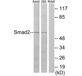 Western Blot - Anti-Smad2 Antibody (B1000) - Antibodies.com