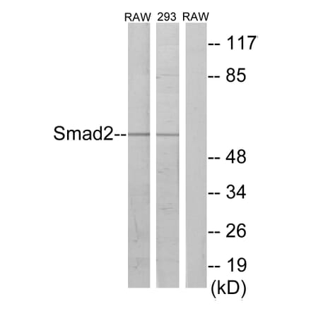 Western Blot - Anti-Smad2 Antibody (B1000) - Antibodies.com