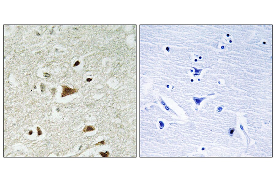 Immunohistochemistry - Anti-Smad2 Antibody (B1000) - Antibodies.com