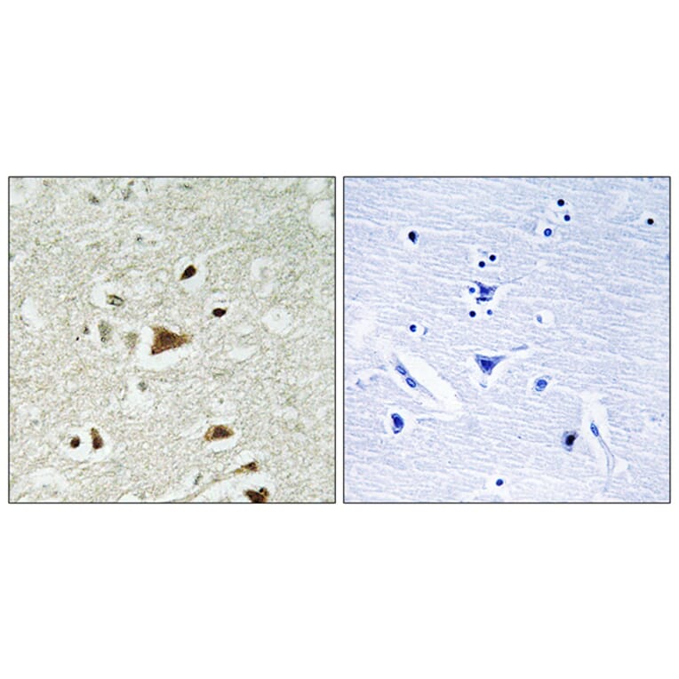 Immunohistochemistry - Anti-Smad2 Antibody (B1000) - Antibodies.com