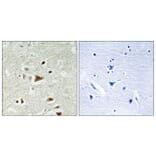 Immunohistochemistry - Anti-Smad2 Antibody (B1000) - Antibodies.com
