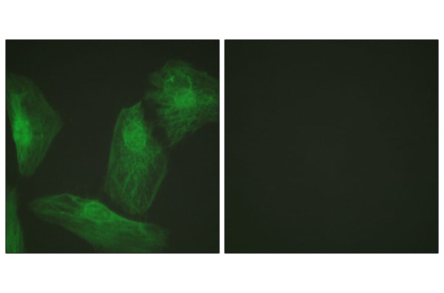 Immunofluorescence - Anti-Smad2 Antibody (B1000) - Antibodies.com