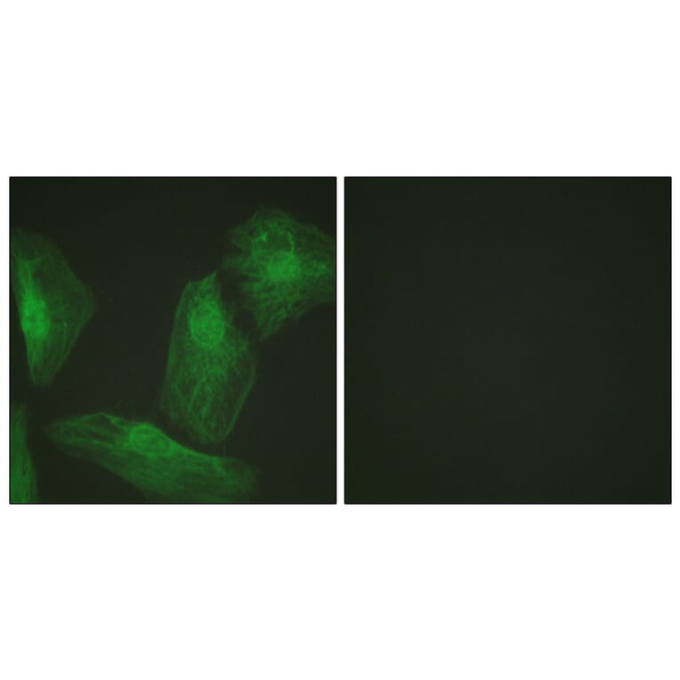 Immunofluorescence - Anti-Smad2 Antibody (B1000) - Antibodies.com