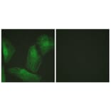 Immunofluorescence - Anti-Smad2 Antibody (B1000) - Antibodies.com