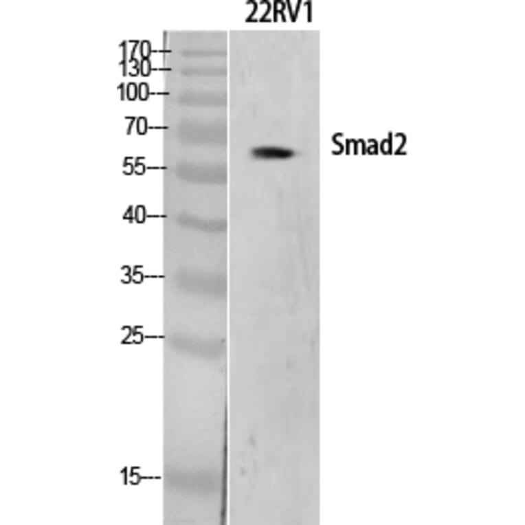 Western Blot - Anti-Smad2 Antibody (B1000) - Antibodies.com