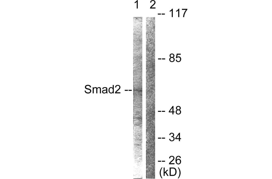 Western Blot - Anti-Smad2 Antibody (B0030) - Antibodies.com