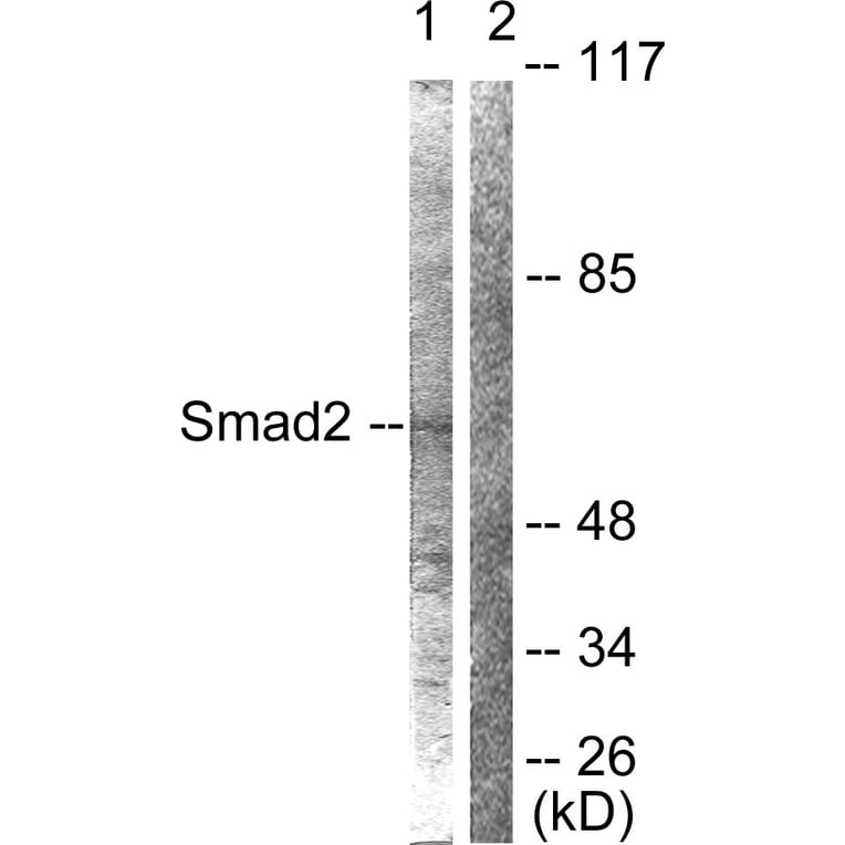Western Blot - Anti-Smad2 Antibody (B0030) - Antibodies.com