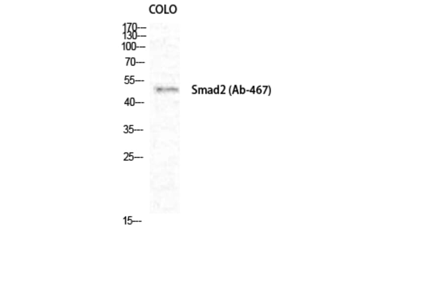 Western Blot - Anti-Smad2 Antibody (B0030) - Antibodies.com