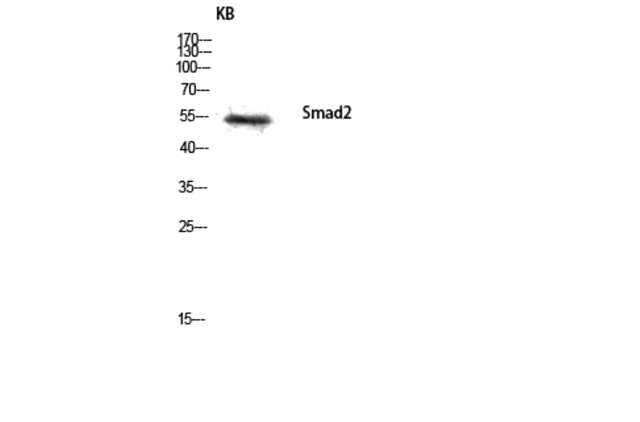 Western Blot - Anti-Smad2 Antibody (B0030) - Antibodies.com