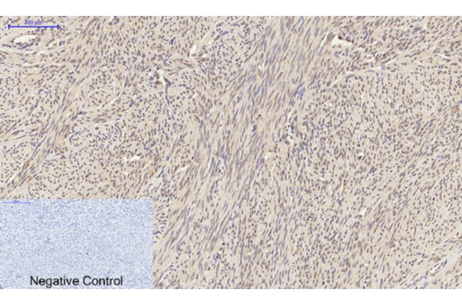 Immunohistochemistry - Anti-Smad2 Antibody (B0030) - Antibodies.com
