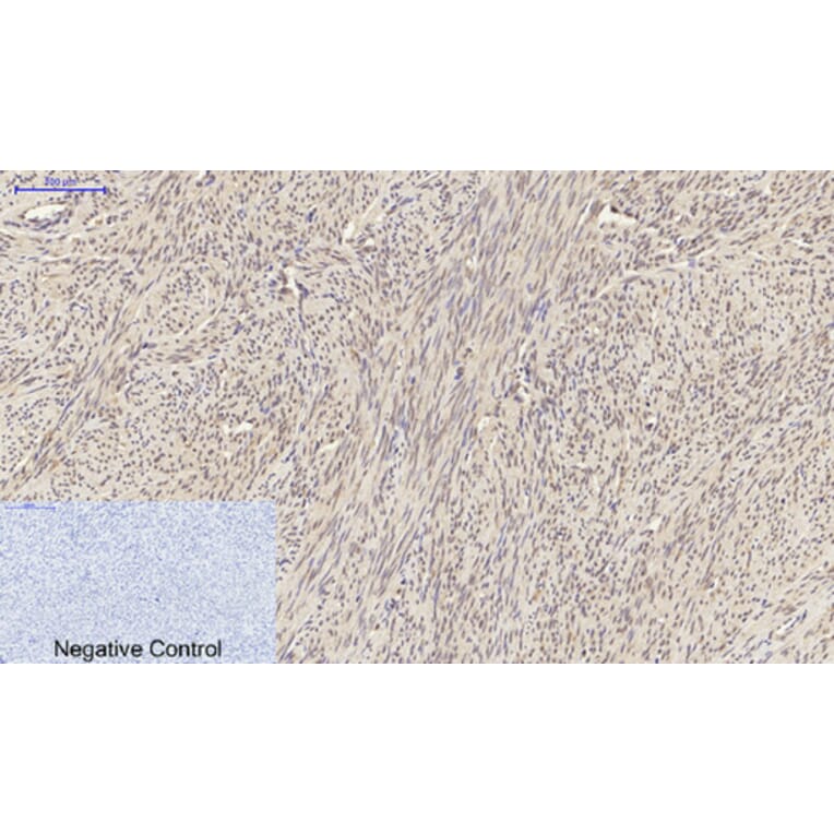 Immunohistochemistry - Anti-Smad2 Antibody (B0030) - Antibodies.com