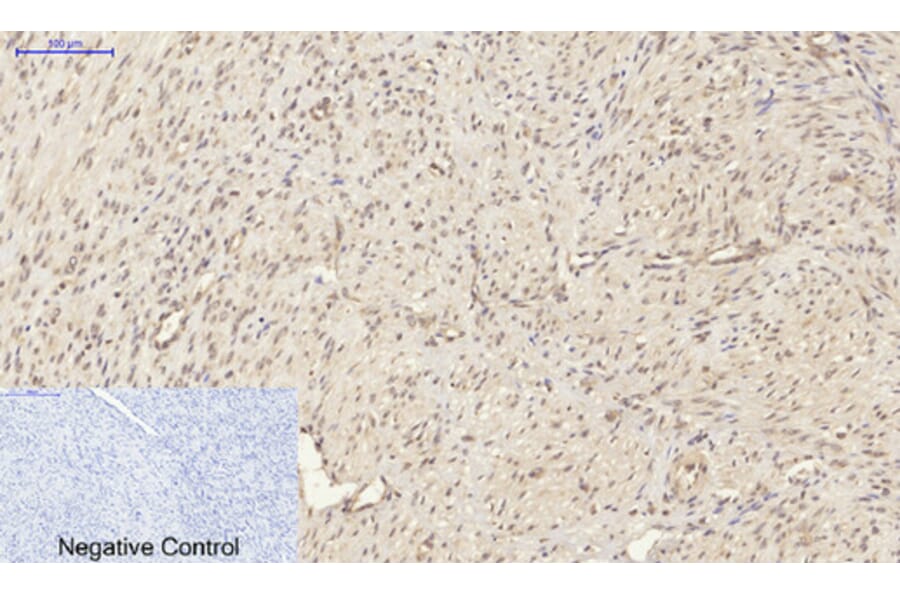 Immunohistochemistry - Anti-Smad2 Antibody (B0030) - Antibodies.com