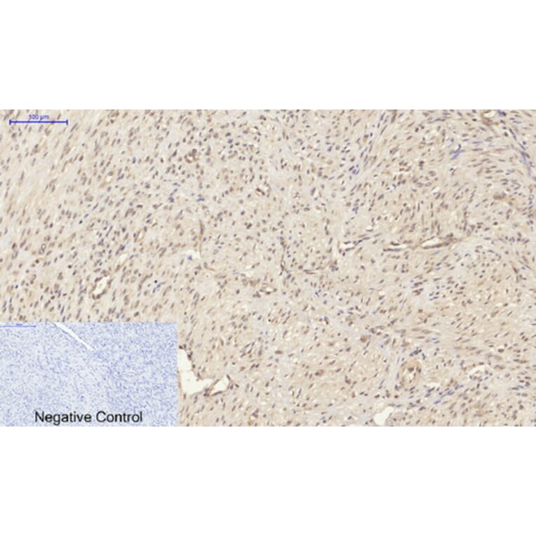 Immunohistochemistry - Anti-Smad2 Antibody (B0030) - Antibodies.com