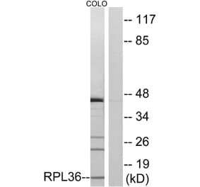 Western Blot - Anti-RPL36 Antibody (C14175) - Antibodies.com
