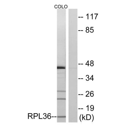 Western Blot - Anti-RPL36 Antibody (C14175) - Antibodies.com