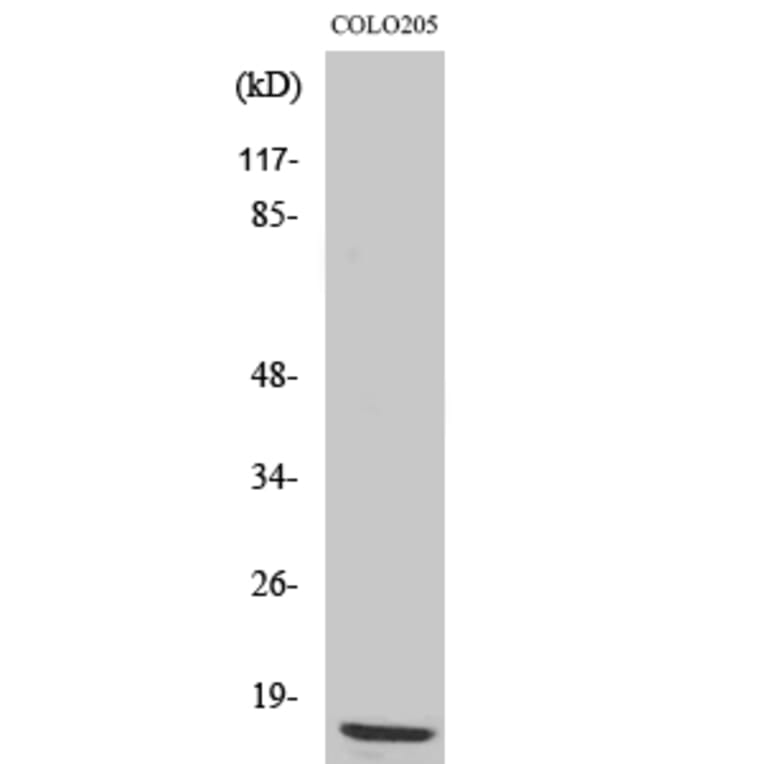 Western Blot - Anti-RPL36 Antibody (C14175) - Antibodies.com