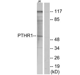 Western Blot - Anti-PTHR1 Antibody (G220) - Antibodies.com